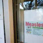 US measles cases. UU. They reach the highest number in 33 years: CDC